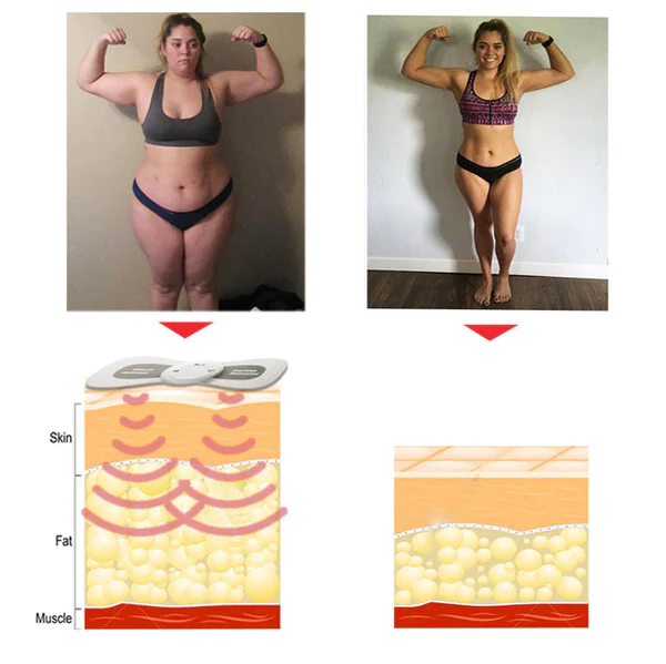 Ricpind Microcurrent HypertensionRelief Massager - Image 4