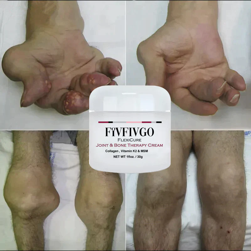 Fivfivgo™ FlexiCure Joint & Bone Therapy Cream - Image 6