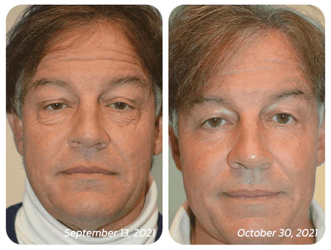 flysmus™ CaffeineEYES Repair and Lifting Eye Cream - Image 2