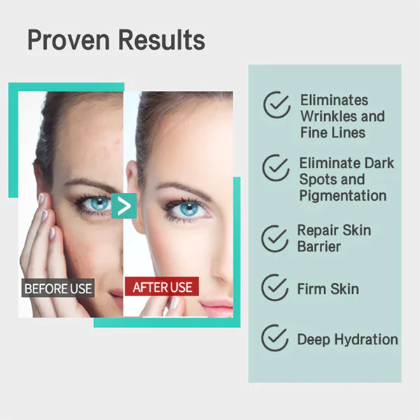 Oveallgo™ MMP Anti-Wrinkle Antioxidant Serum - Image 4