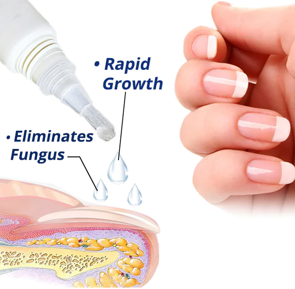 flysmus™ 7 Days Nail Recovery Rapid Growth Essence Pen - Image 3