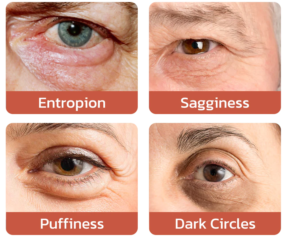 flysmus™ CaffeineEYES Repair and Lifting Eye Cream - Image 7