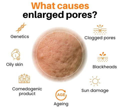 DermaZen™ Pore Minimizer Facial Mask - Image 6