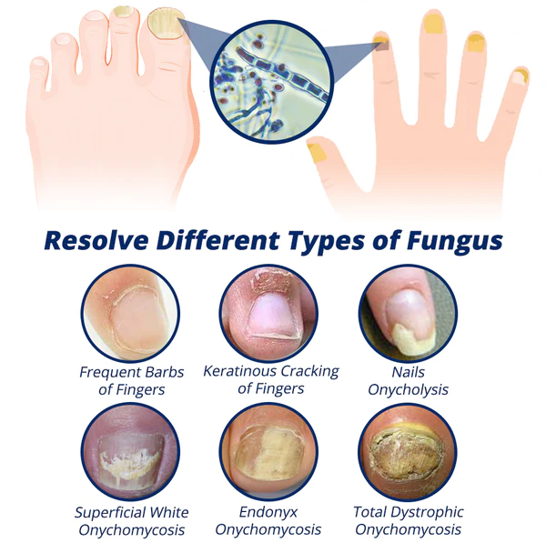 flysmus™ 7 Days Nail Recovery Rapid Growth Essence Pen - Image 4