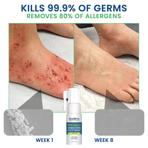 Blusoms™ PROBRIO Debacteria Foot Spray - Image 3