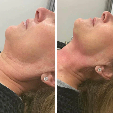 HeaLymph™ Treatment Patch - Image 7