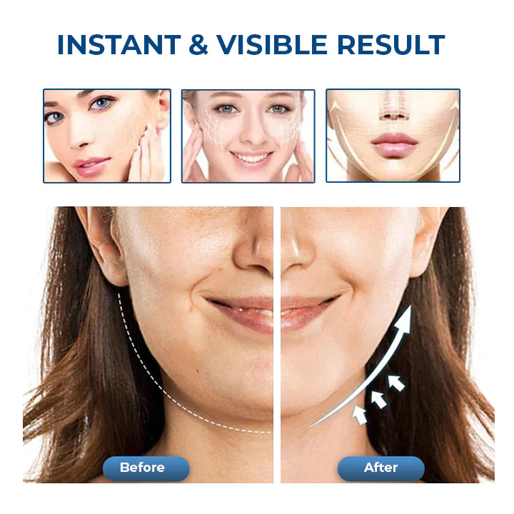 Oveallgo™ SleepBeauty Face Sculptor - Image 5