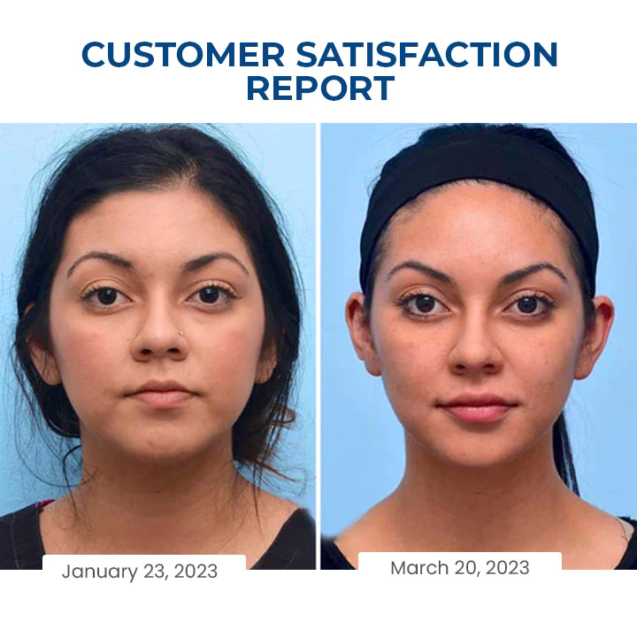 Oveallgo™ SleepBeauty Face Sculptor - Image 9