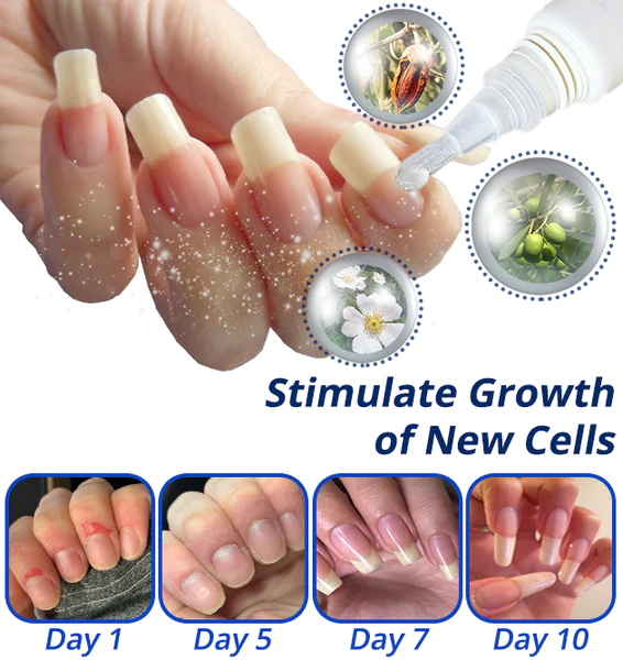 flysmus™ 7 Days Nail Recovery Rapid Growth Essence Pen - Image 5