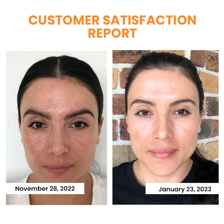 Oveallgo™ Korean PRO Dermalayr Technology Soluble Collagen Film - Image 6