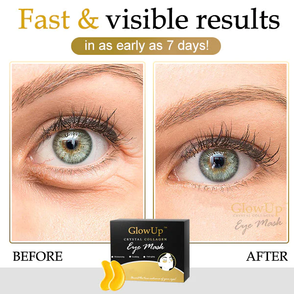 GlowUp™ Crystal Collagen Eye Mask - Image 3