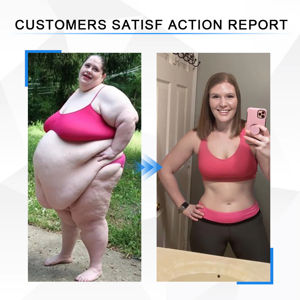 Hapygo™Fulgurite Ionic Body Shaping Stretch Knee Brace - Image 6