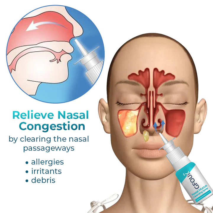 Oveallgo™ Nasal Mucus Cleansing Spray - Image 2