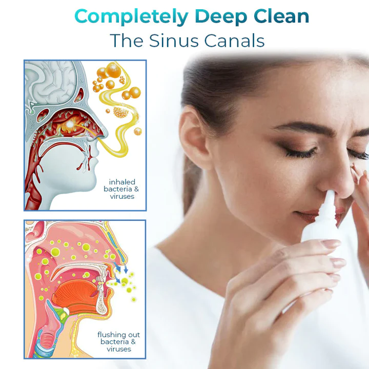 Oveallgo™ Nasal Mucus Cleansing Spray - Image 3