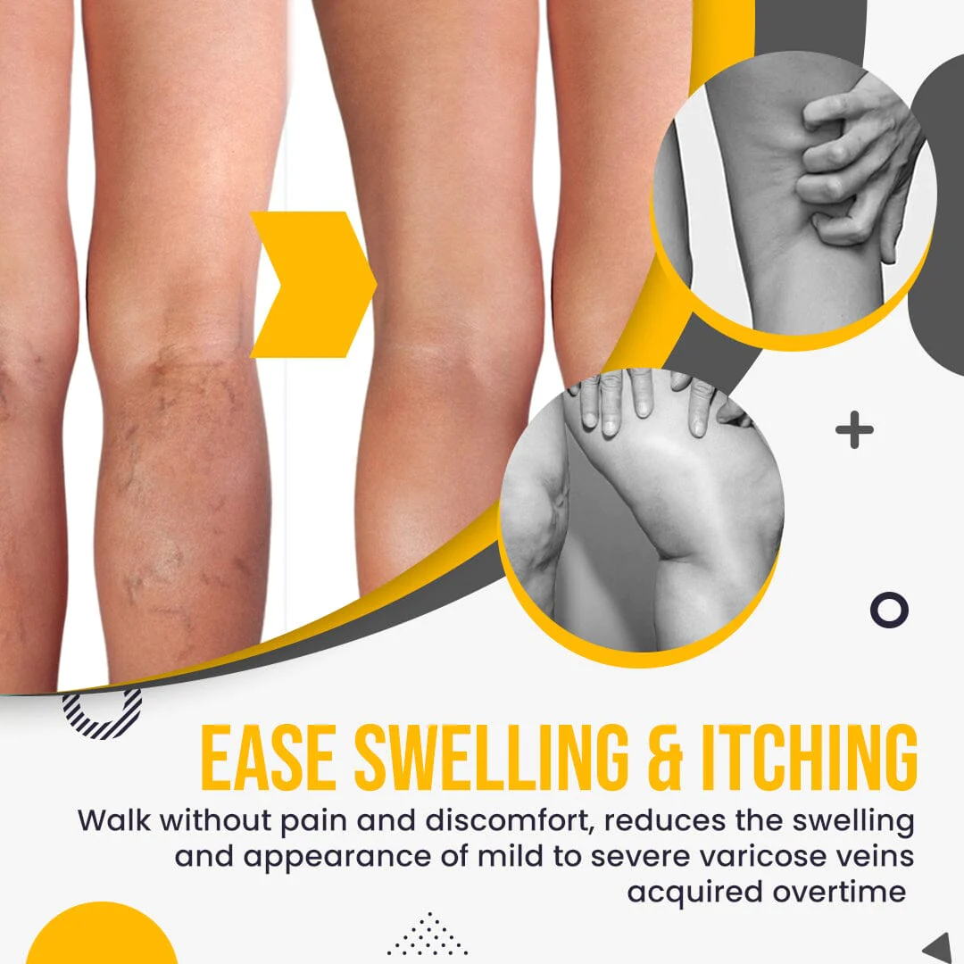 Raura™ Varicose Veins Treatment Patches - Image 8