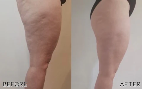 Oveallgo™ Avocado Ageless Body Cream Scrub - Image 3