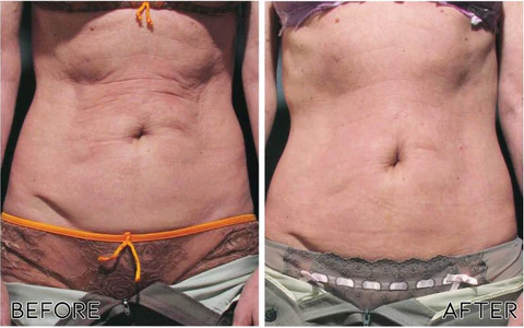 Oveallgo™ Avocado Ageless Body Cream Scrub - Image 2