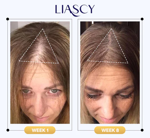 Liascy™ Shine Anti-Thinning Treatment - Image 7
