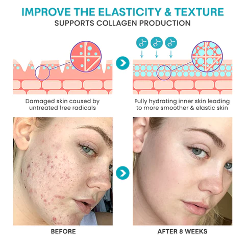 Liascy™ HyaloVitality Microdarts Roller - Image 7