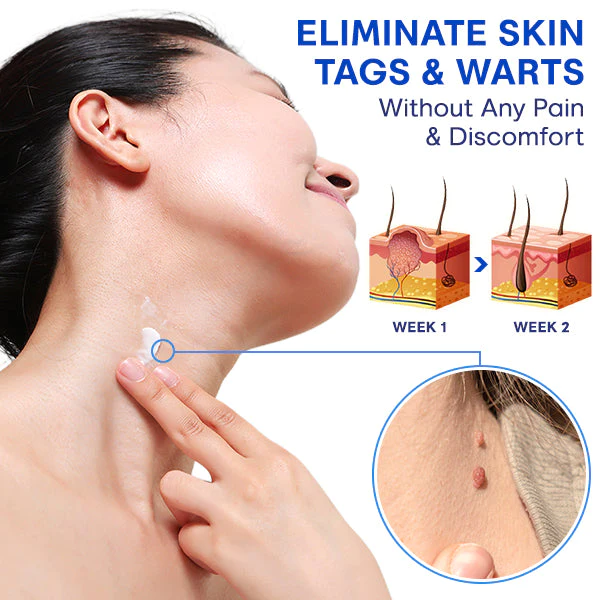 Blusoms™ FreezeZap WartGone Serum - Image 3