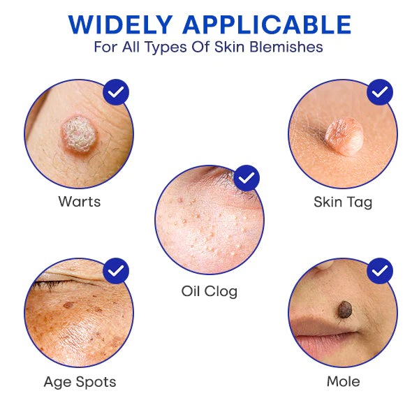 Blusoms™ FreezeZap WartGone Serum - Image 5