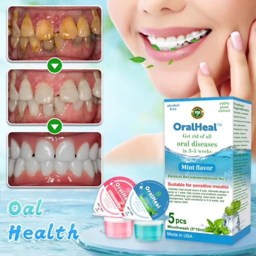 OralHeal™ جيلي ڪپ ماؤٿ واش دانت ۽ وات کي صحت لاءِ بحال ڪري ٿو