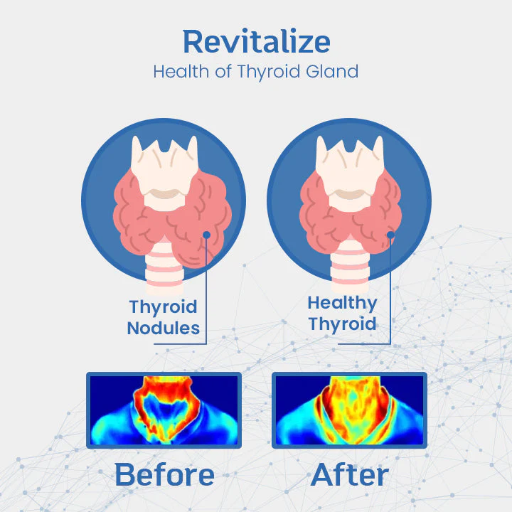 Ceoerty™ ThyroCare Lymph Cleanse Roller - Image 6