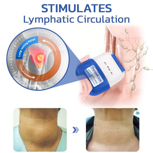 GFOUK™ ThyroidCare Anti Swelling Lymphatic Cleaning Roller - Image 2