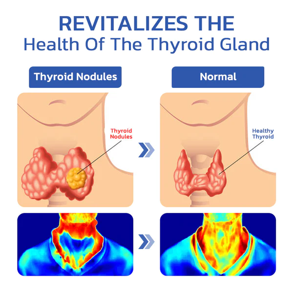 GFOUK™ ThyroidCare Anti Swelling Lymphatic Cleaning Roller - Image 4