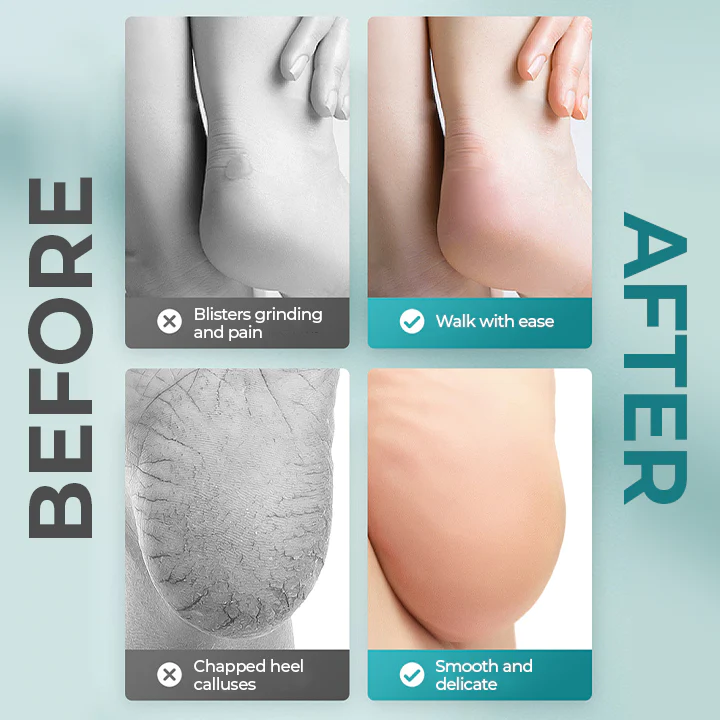 GreenBots™ Anti-Wear Foot Care Stick - Image 5