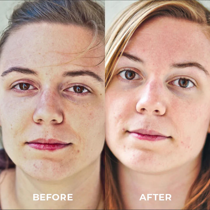 NATUREVita™ T3 Lavender Sleep Spray - Image 8