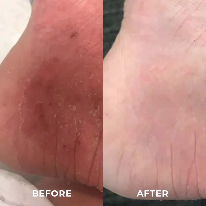 GreenBots™ Anti-Wear Foot Care Stick - Image 8