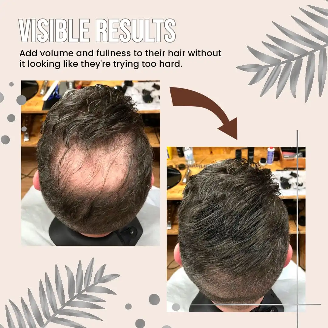 Richroyals™ Hair Thickening Fibres - Image 8