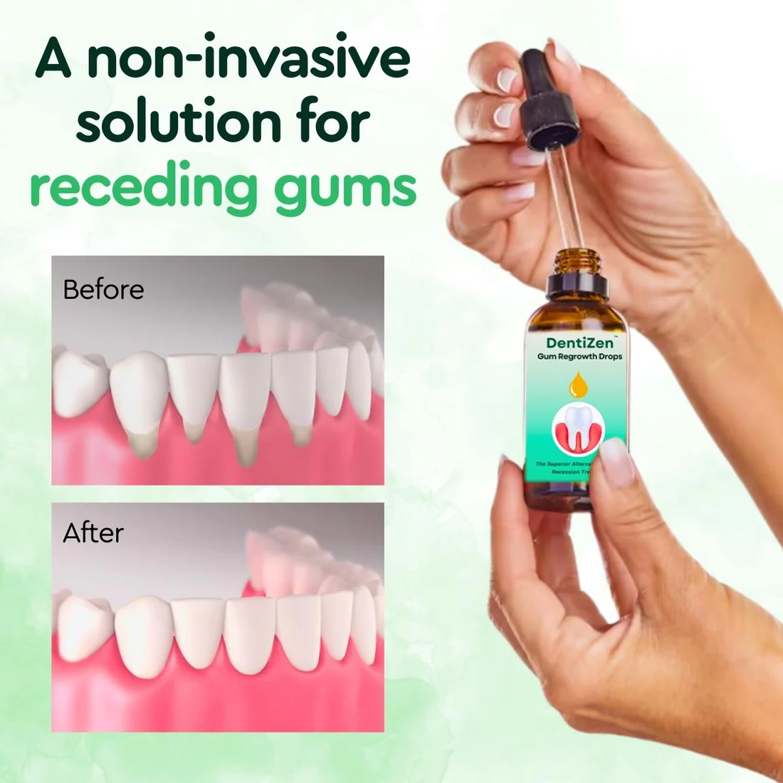 DentiZen™ Gum Regrowth Drops - Image 2