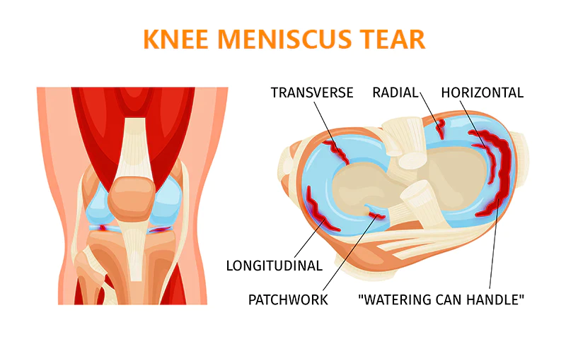 Oveallgo™ Bee Venom Joint & Bone Therapy Spray(Full Body Recovery) - Image 8