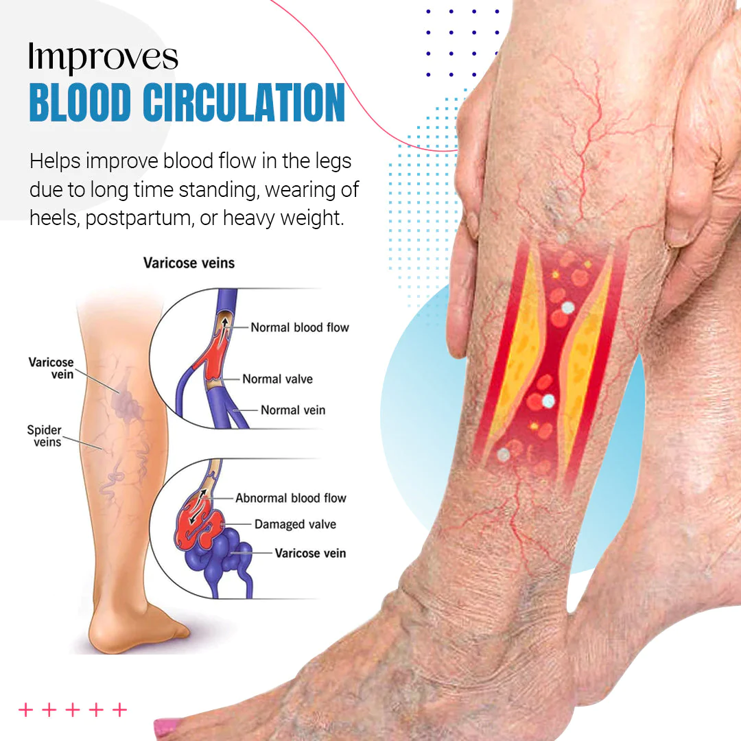 Raura™ Varicose Veins Treatment Spray - Image 4