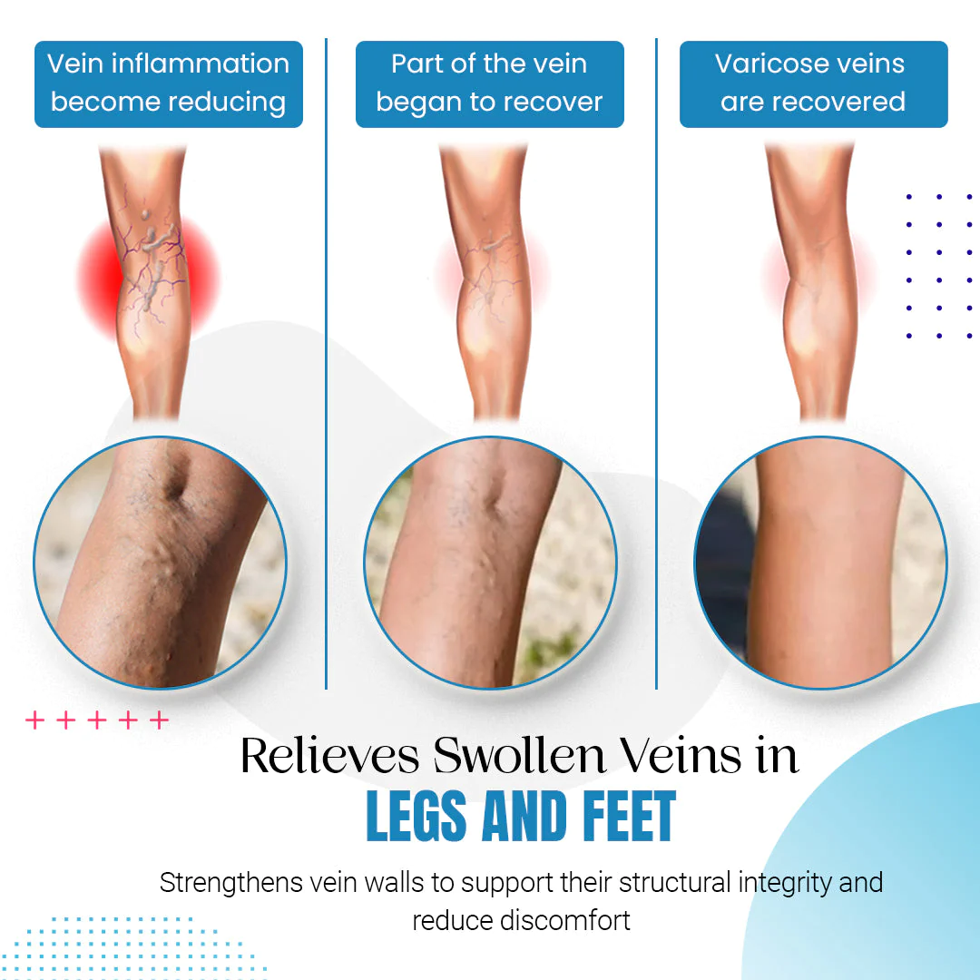 Raura™ Varicose Veins Treatment Spray - Image 7
