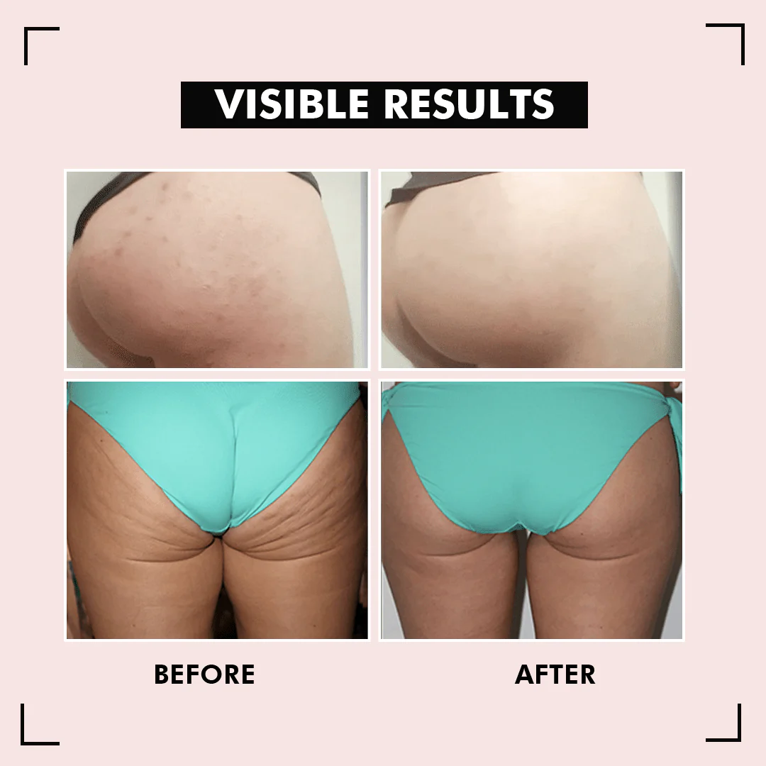 HipShine™ Perfect Butt Mask - Image 9
