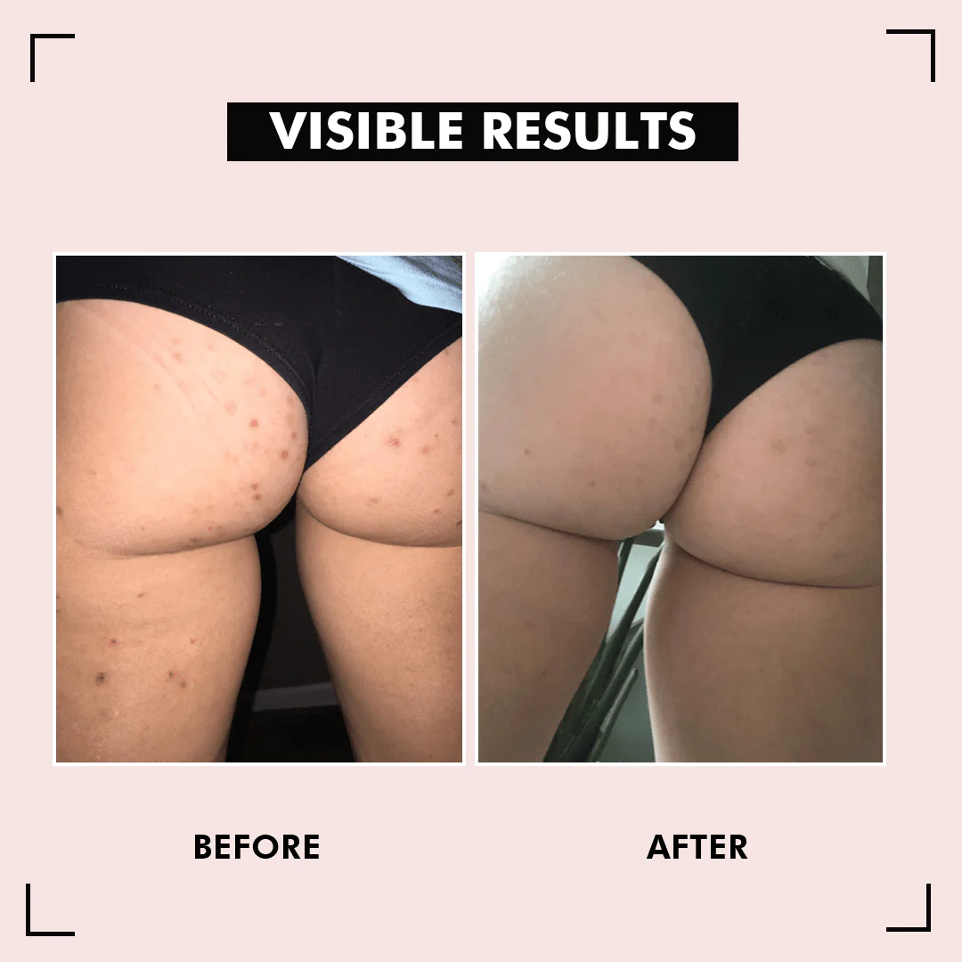 HipShine™ Perfect Butt Mask - Image 5