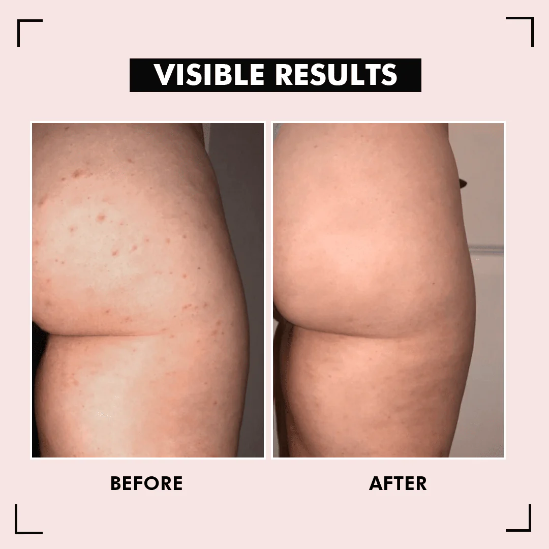 HipShine™ Perfect Butt Mask - Image 3