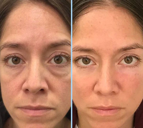 Ceoerty™ Youth Magic Electric Massage Eye Cream - Image 6