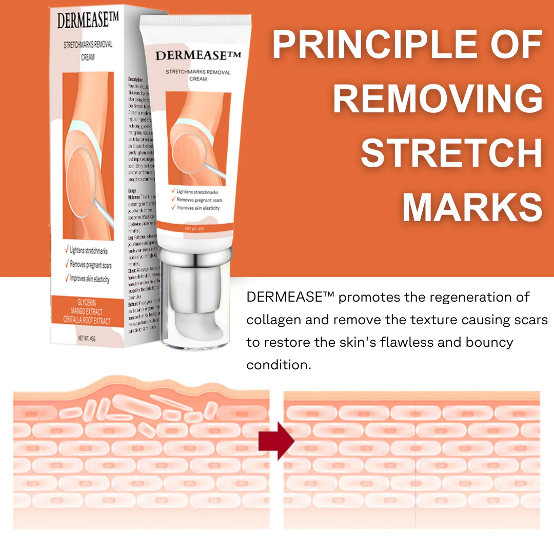 DERMEASE™ Stretchmarks Removal Cream - Image 2