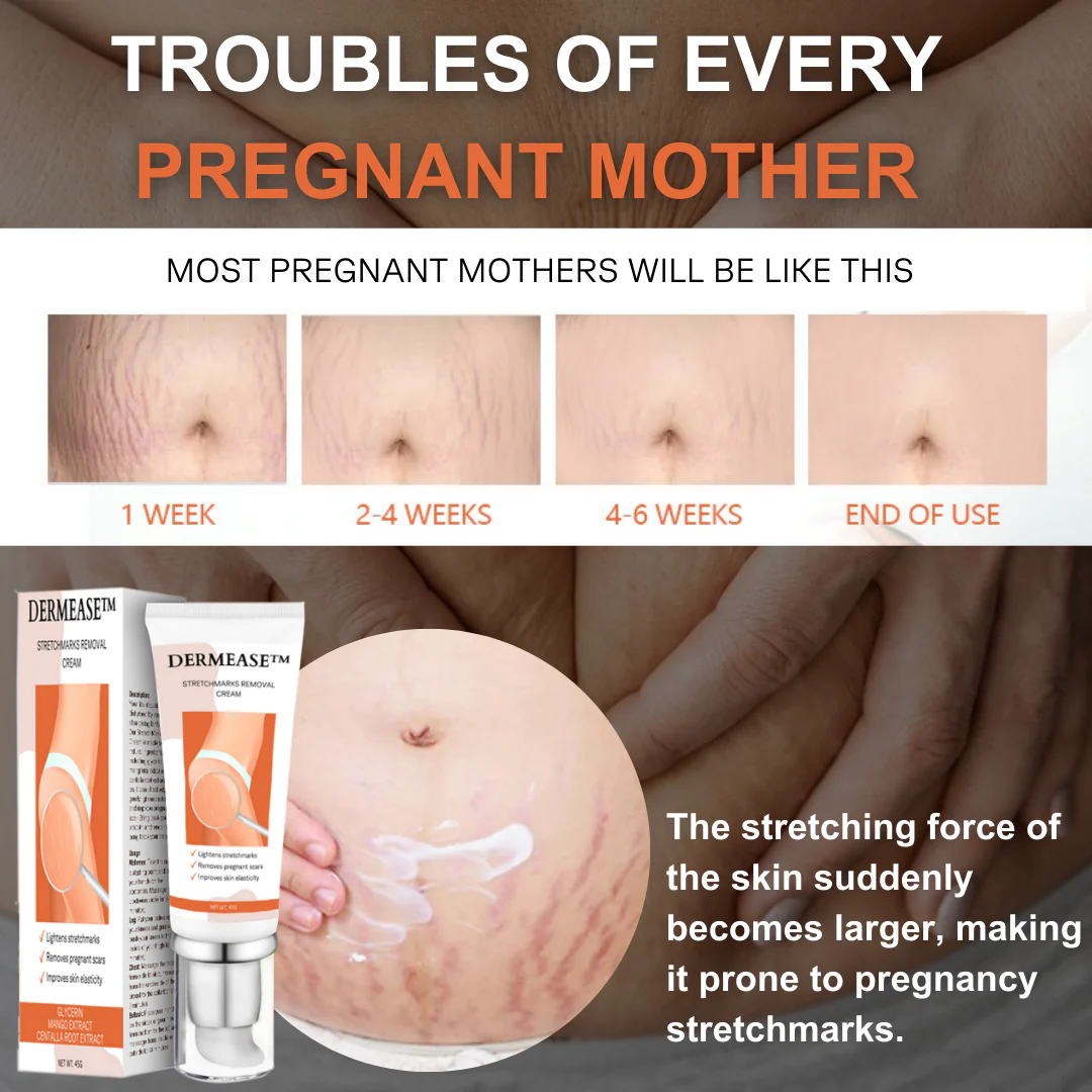 DERMEASE™ Stretchmarks Removal Cream - Image 4