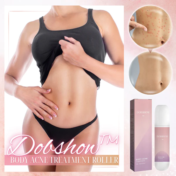 Dobshow™ Body Acne Treatment Roller - Image 2