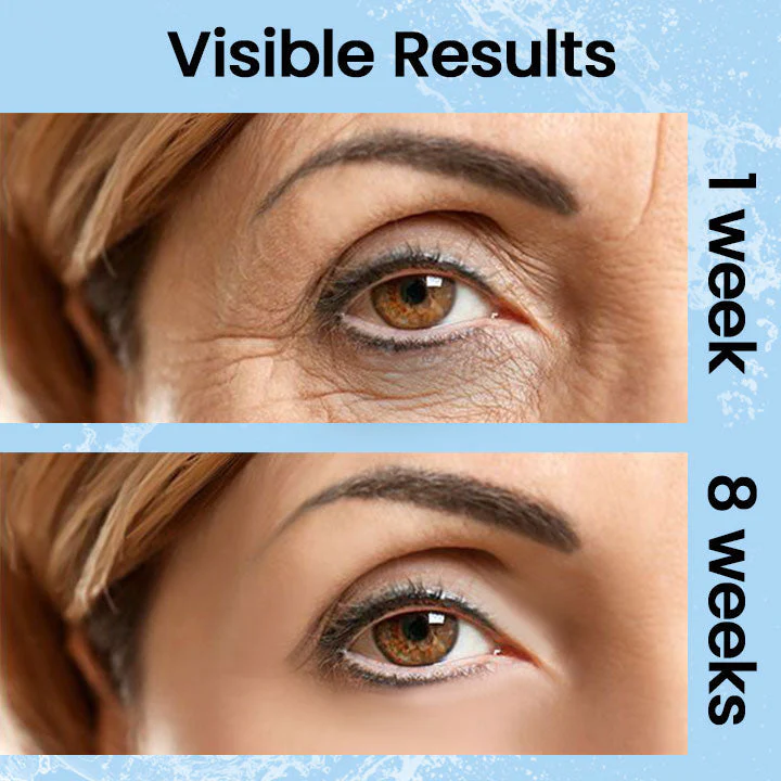 Ceoerty™ Youth Magic Electric Massage Eye Cream - Image 7