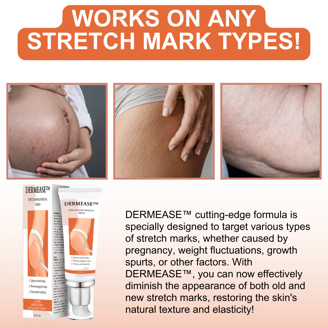 DERMEASE™ Stretchmarks Removal Cream - Image 3