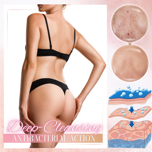 Dobshow™ Body Acne Treatment Roller - Image 3