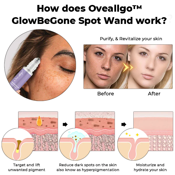 Oveallgo™ GlowBeGone Spot Wand - Image 2