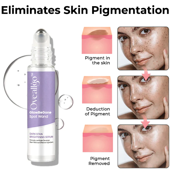 Oveallgo™ GlowBeGone Spot Wand - Image 3