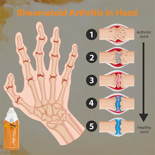 Oveallgo™ Bee Venom Joint & Bone Therapy Spray(Full Body Recovery) - Image 4